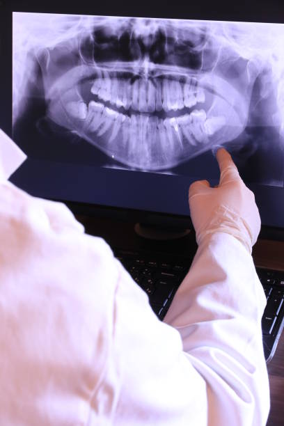 Best Emergency Denture Repair in Vandenberg Village, CA